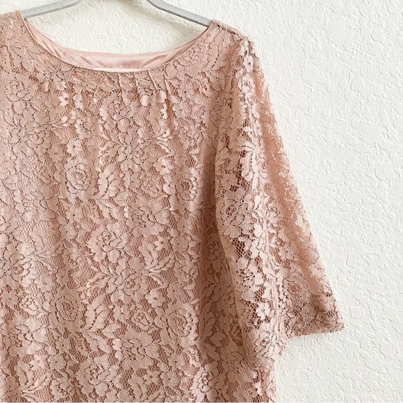 Fossil•Retro Lace Shift Dress - Picture 2 of 10